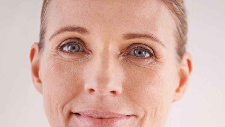 wrinkles-165941547416x9